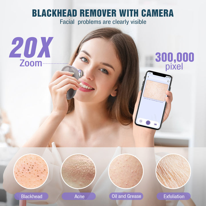 Blackhead Remover Pore Vacuum with Camera